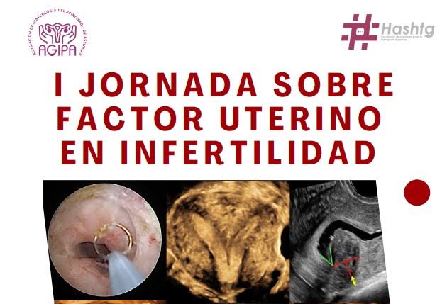 I JORNADA DE FACTOR UTERINO EN INFERTILIDAD